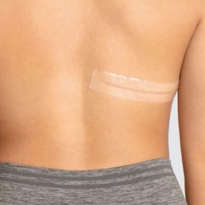 CuraScar therapy- Silicone scar patch