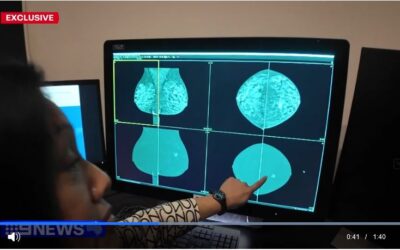 New technique revolutionizes breast cancer screening